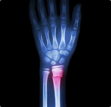 Orthopedic Injuries - Basin Orthopedic Surgical Specialists